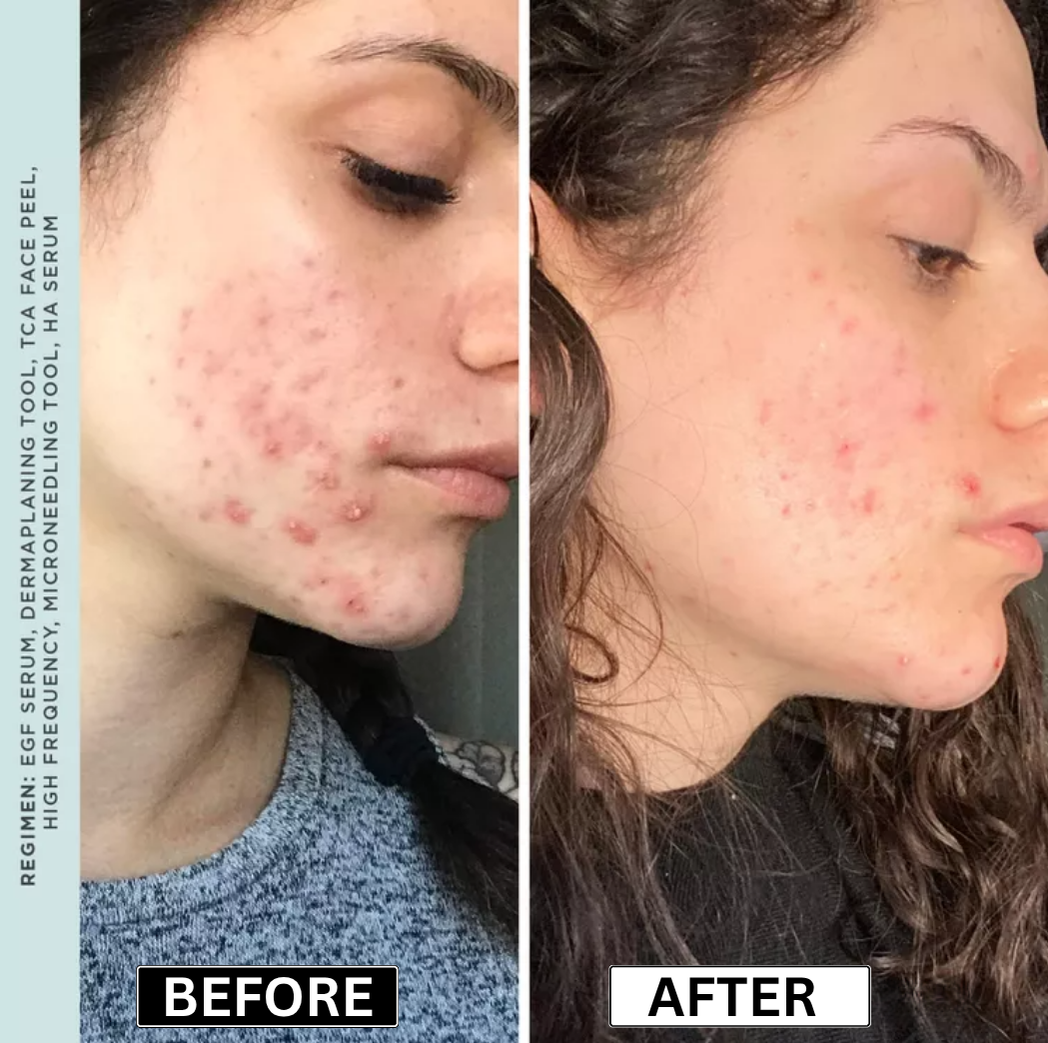 Laurel Derma
