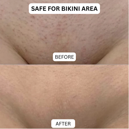 Crystal Magic Hair Remover