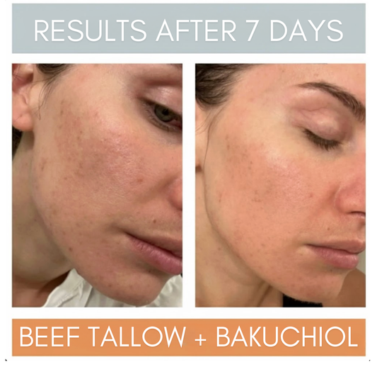 Laurel Beef Tallow + 1% Bakuchiol